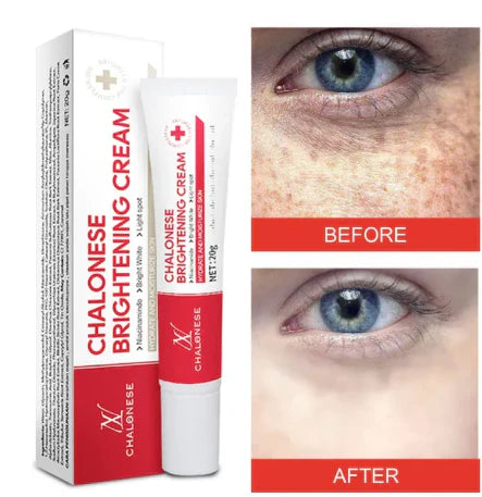 Chalonese Brightening Cream – Buy 1 Get 1 Free